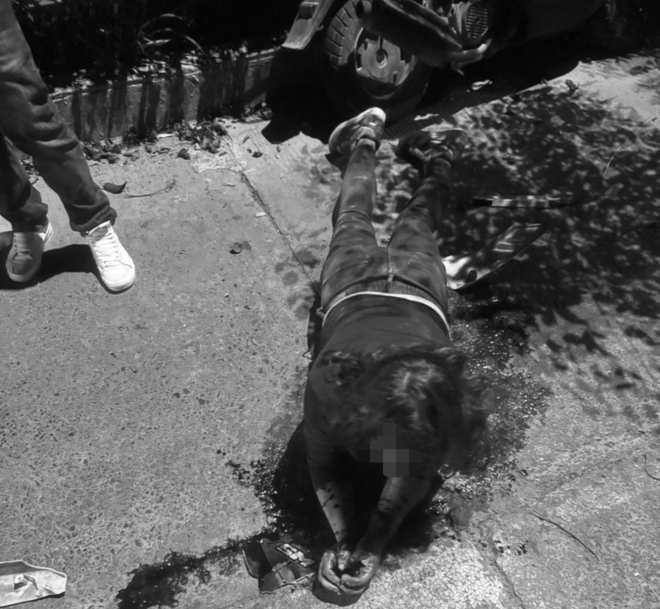 Mujer sufre fuerte accidente en motocicleta